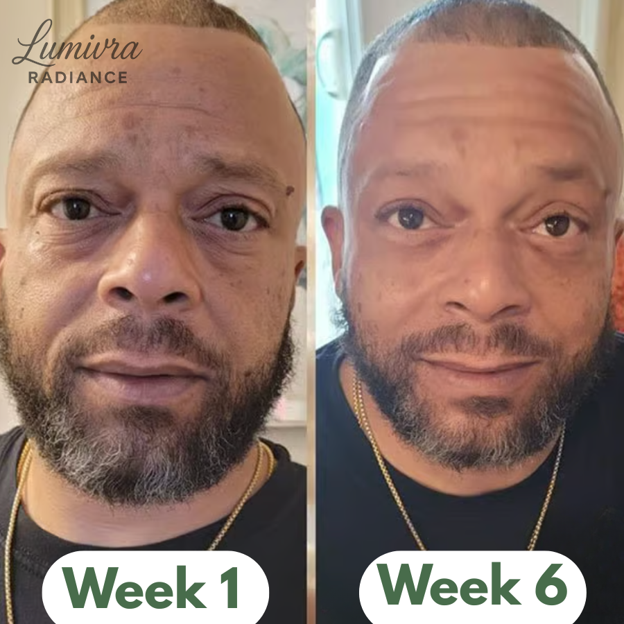 Lumivra Avocado Eye Mask